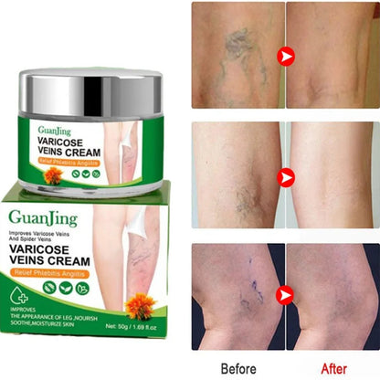 Crema Anti Varices VARICOSE CREAM