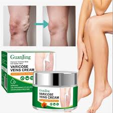 Crema Anti Varices VARICOSE CREAM