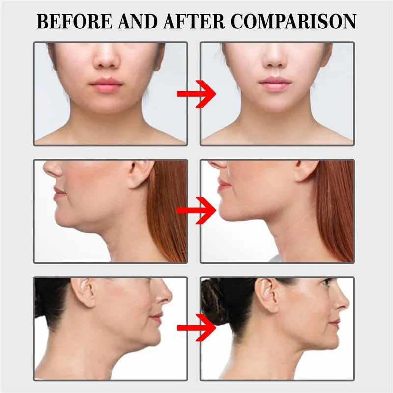 Cinta Invisible V-Shape Lifting