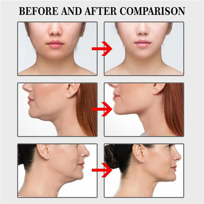 Cinta Invisible V-Shape Lifting
